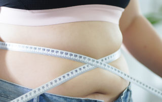 Person with measuring tape around her stomach to illustrate bariatric surgery weight loss